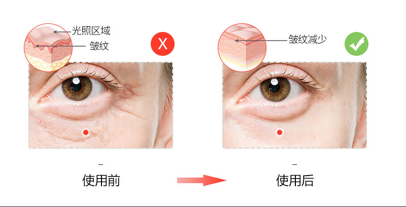美容面罩详情._07