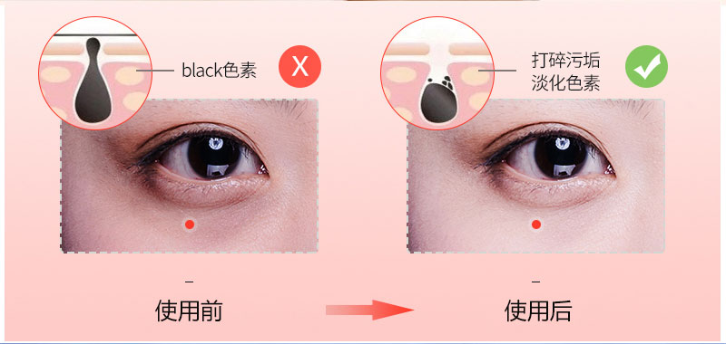 美容面罩详情._11