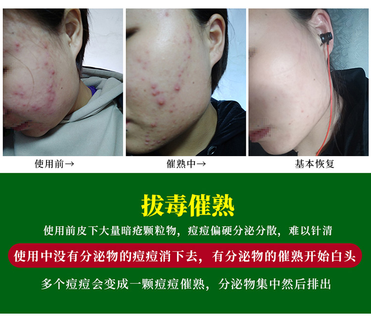2020-6-20新详情-1_08