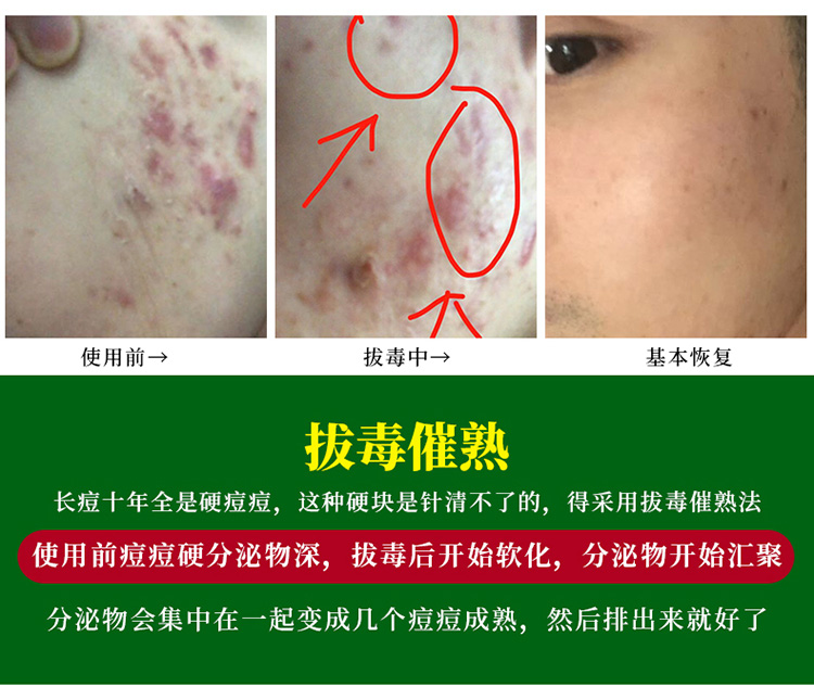 2020-6-20新详情-2_01